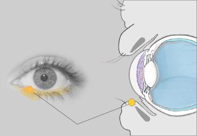 علاج أكياس العين الدهنية